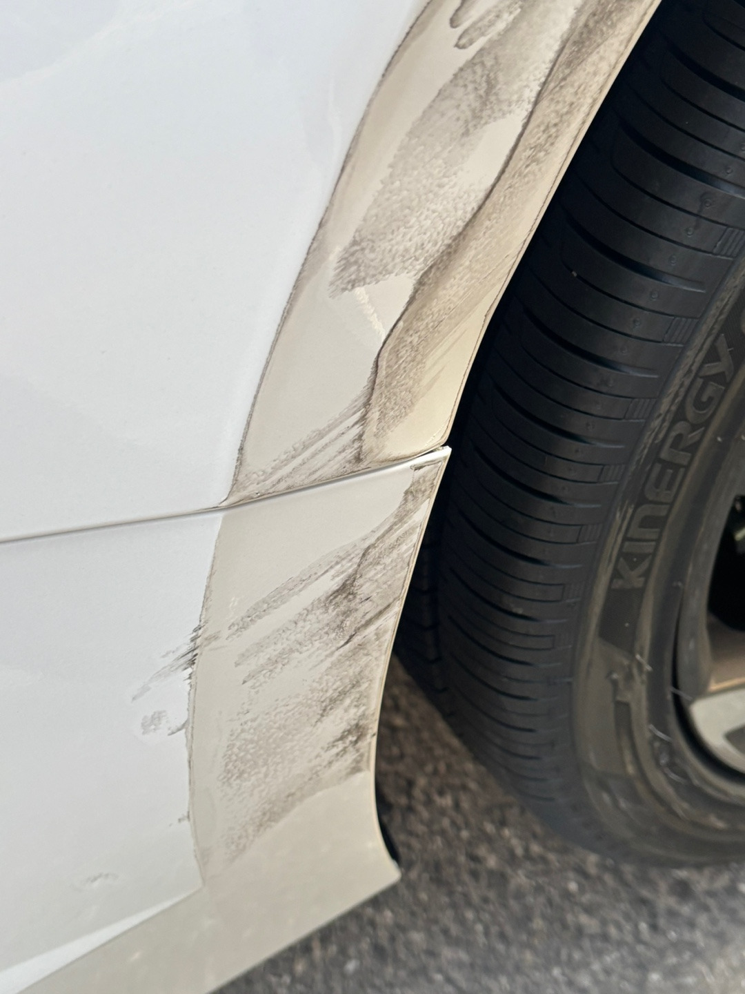 경미한 교통사고 합의금